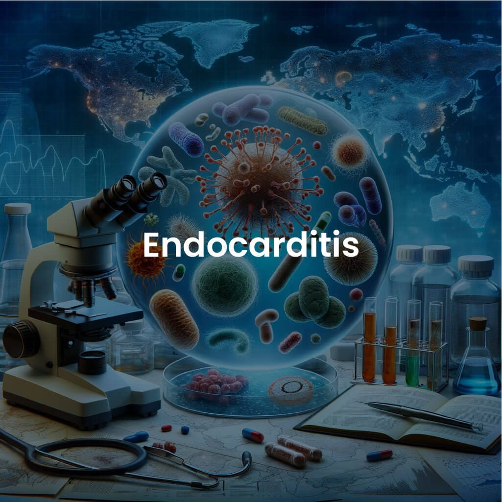 Enfoque diagnóstico terapéutico de la endocarditis aguda