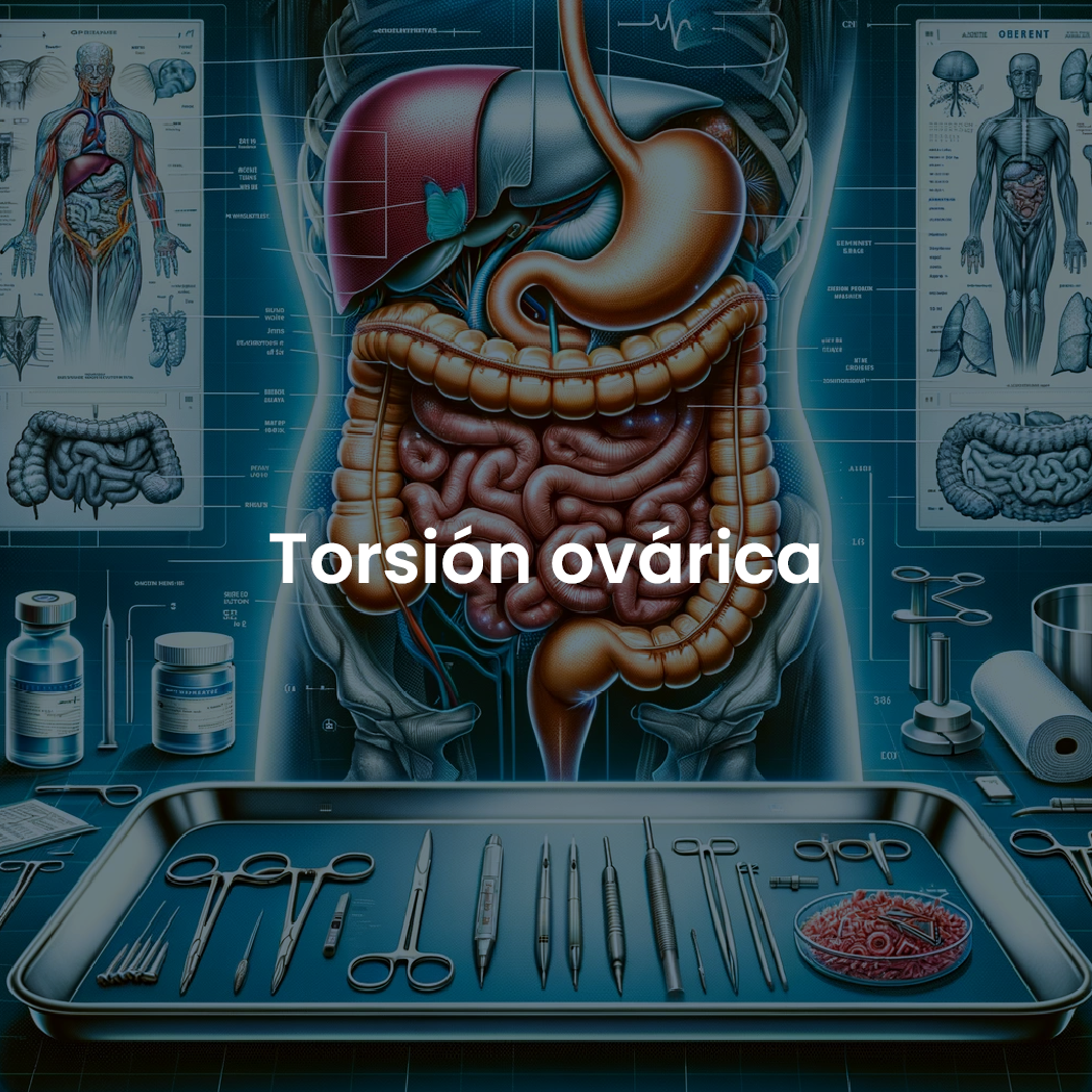 Torsión ovárica