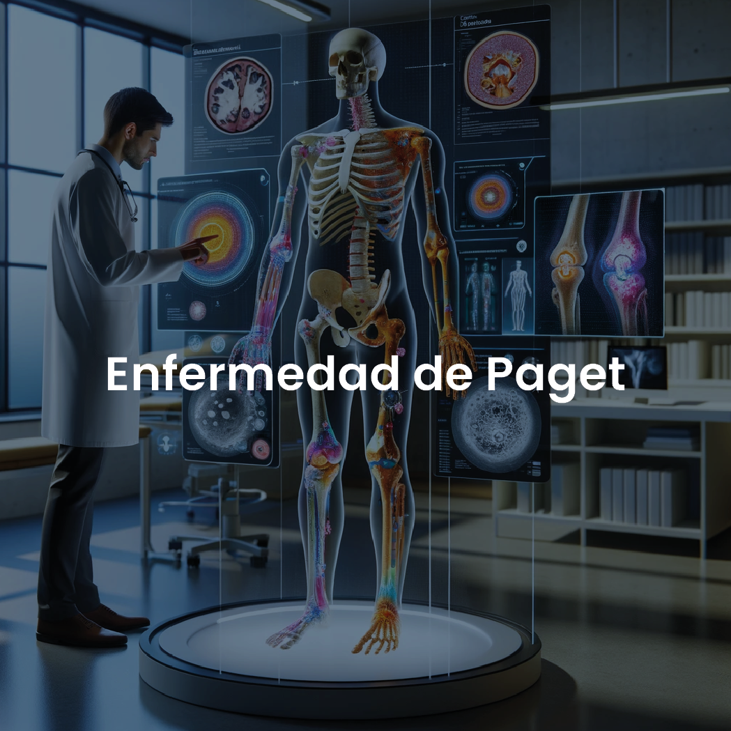 ENFERMEDAD DE PAGET