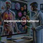 Hipercalcemia tumoral