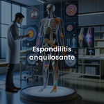 Espondilitis Anquilosante